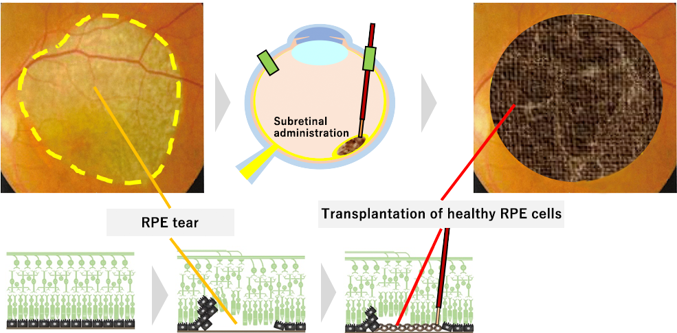 Our Goal with Regenerative and Cellular Therapy2