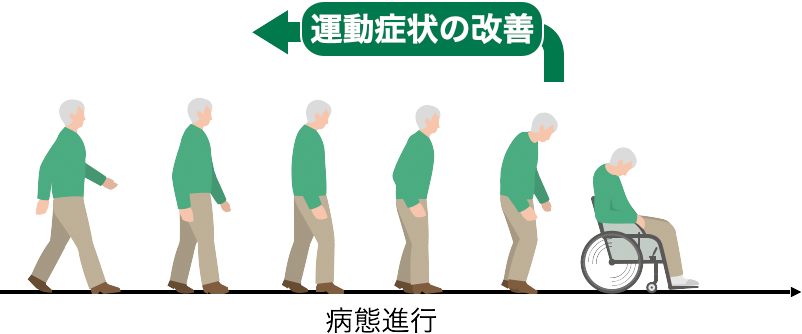 運動症状の改善