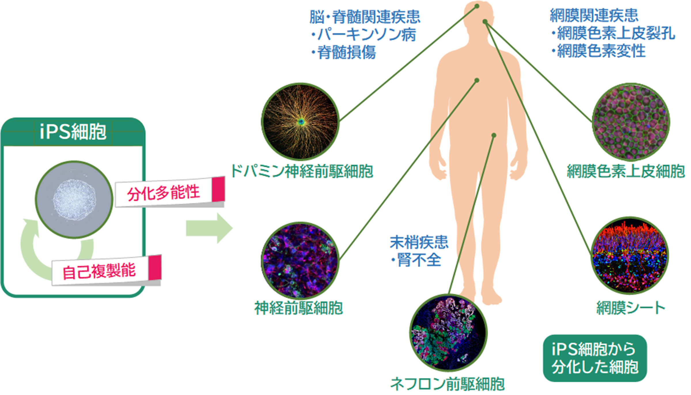 iPS細胞から分化した細胞