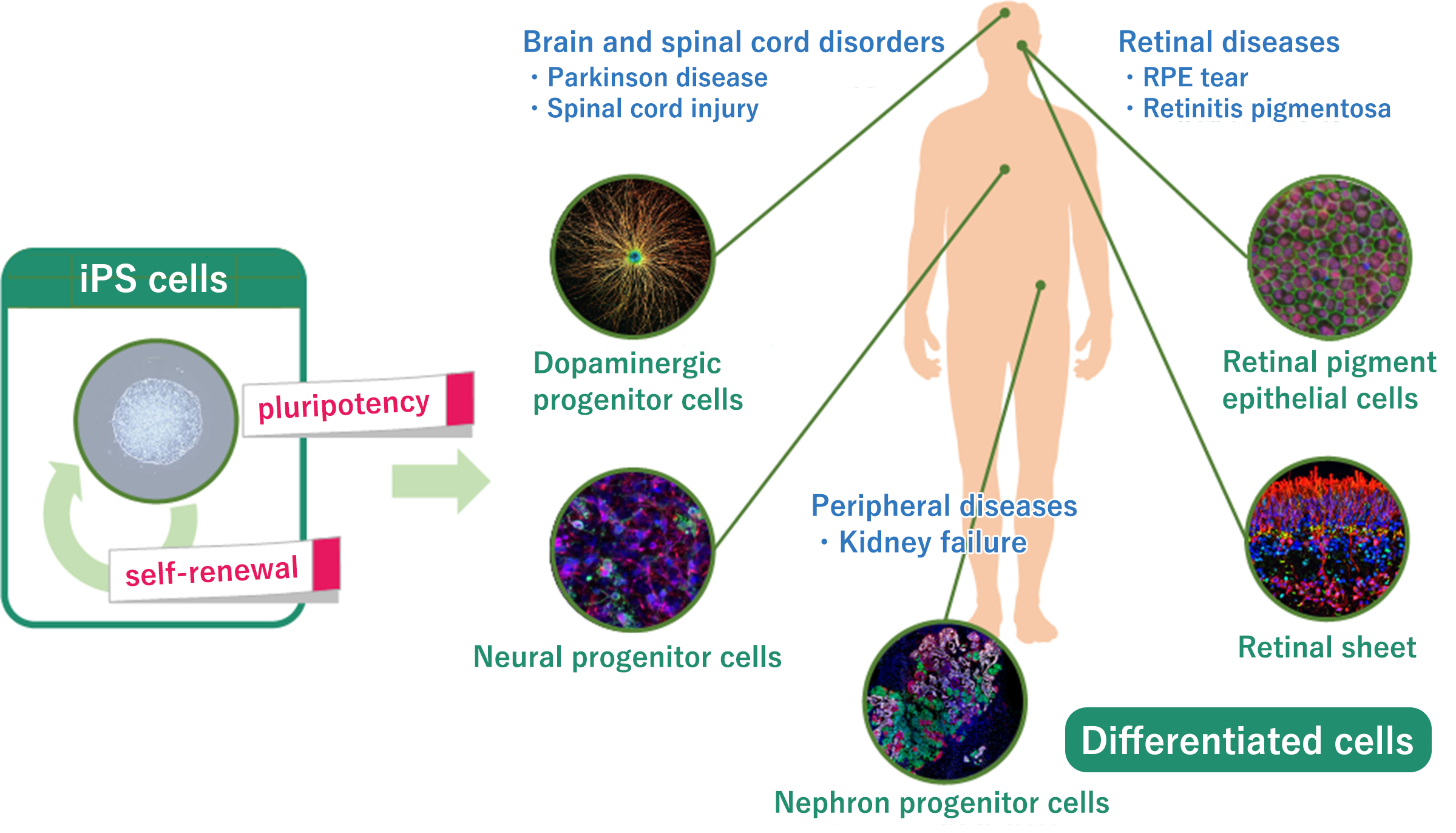 Cells differentiated from iPS cells