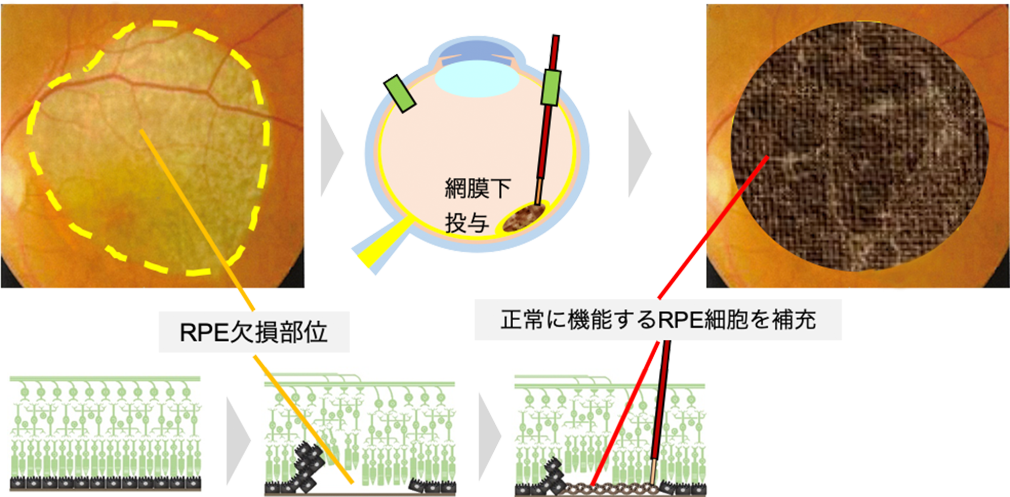 再生・細胞医薬により目指すこと2