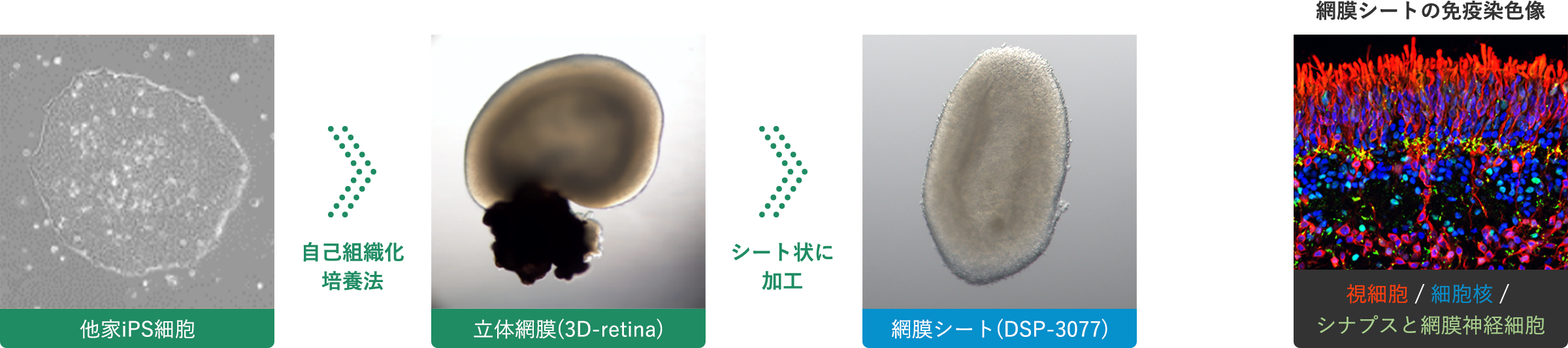 iPS細胞から網膜シートを作製